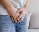 ¿Cuáles son los síntomas del VPH en hombres?