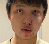 Golpean a estudiante de Singapur por culpa del coronavirus