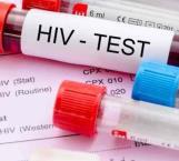 Confirman segundo caso curado de VIH