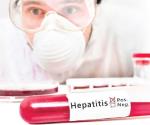 Buscan prevenir los casos de hepatitis
